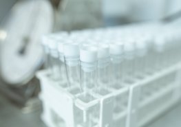 Omezení provozu odběrových center oddělení klinické biochemie a diagnostiky