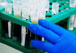 Aktualita OKBD – informace pro lékaře