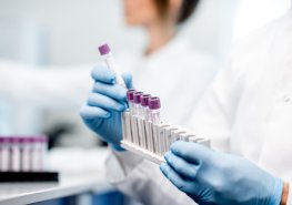 Omezení provozu odběrového centra oddělení klinické biochemie a diagnostiky