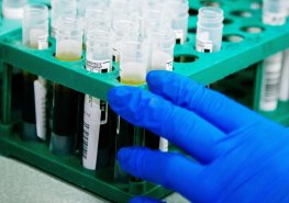 Aktualita OKBD – informace pro lékaře