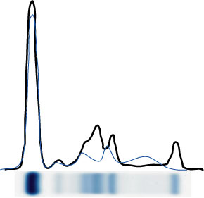 Hemol�za + monoklon�ln� gradient