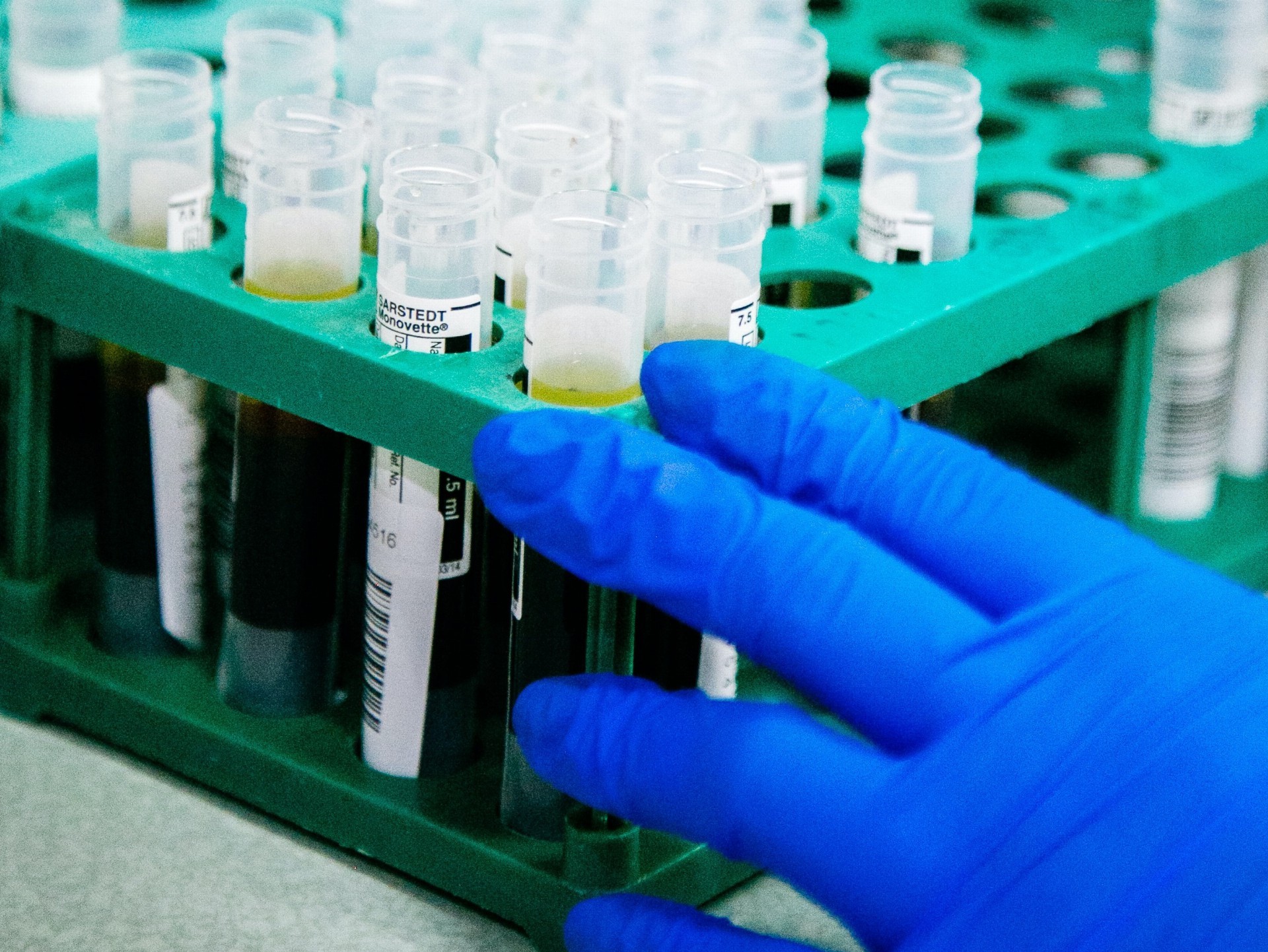 Aktualita OKBD – změna jednotek FOB